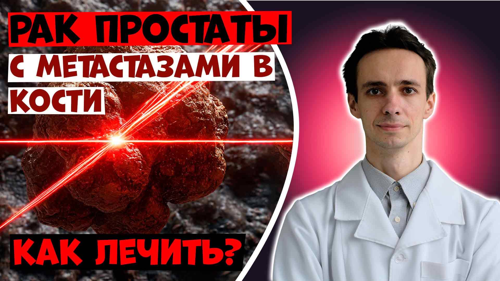 Метастазы рака простаты в кости: современные методы лечения. смотреть онлайн