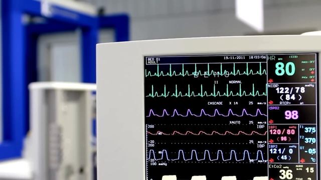 СМАЕВ ВЕРНУЛСЯ И НЕ СГНИЛ, НО ЕСТЬ ОДНО НО...