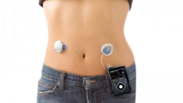 Medtronic MiniMed - Introducción al sistema MiniMed® 640G