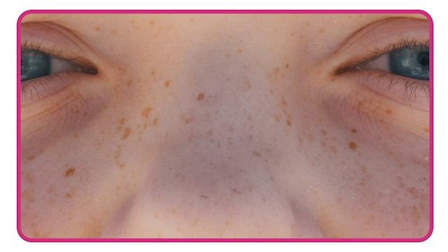 Vocabulary presentation 01-01_ Freckles смотреть онлайн