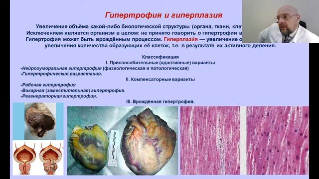 Лекцияя: 12.11.21. 10.25 Компенсаторно-приспособительные процессы смотреть онлайн