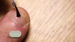 Как избавиться от грибка на ногах? Лучшее лечение грибка на стопах и пальцах