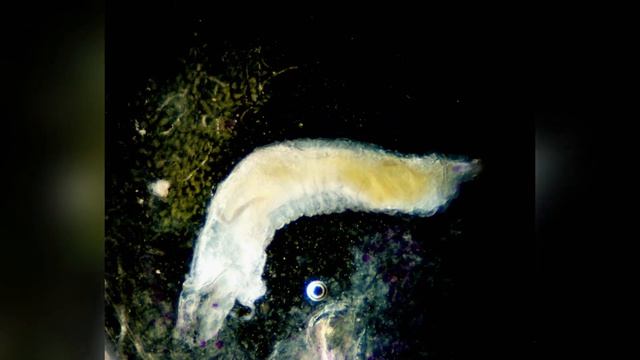 Паразитирующие черви в инжире #подмикроскопом #гельминты #паразиты смотреть онлайн