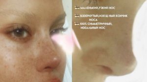 𝐛𝐮𝐭𝐭𝐨𝐧 𝐧𝐨𝐬𝐞 | маленький,вздернутый носик 📀 subliminal ¹