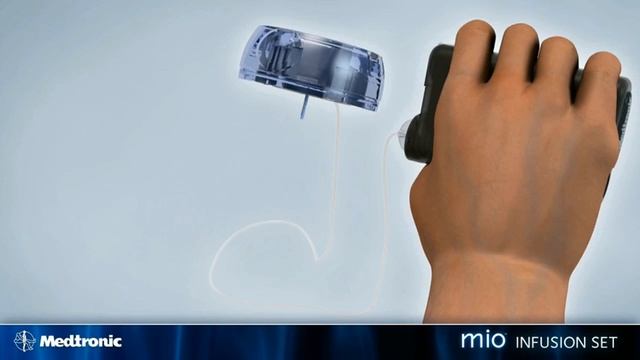 Medtronic Mio Infusion Set - How To Guide