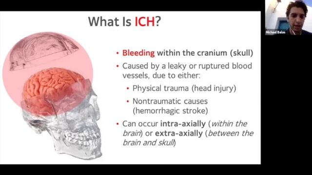 Discovering gene-disease relationships with deep learning & Using AI for intracranial hemorrhages смотреть онлайн