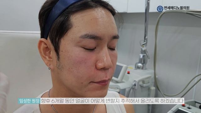 30대 후반의 얼굴이 20대로 바뀐 비결 смотреть онлайн