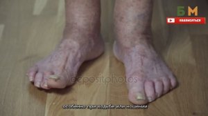 Лучшее средство от Грибка Ногтей. Запомни 1 народный способ как избавиться  грибок ногтей