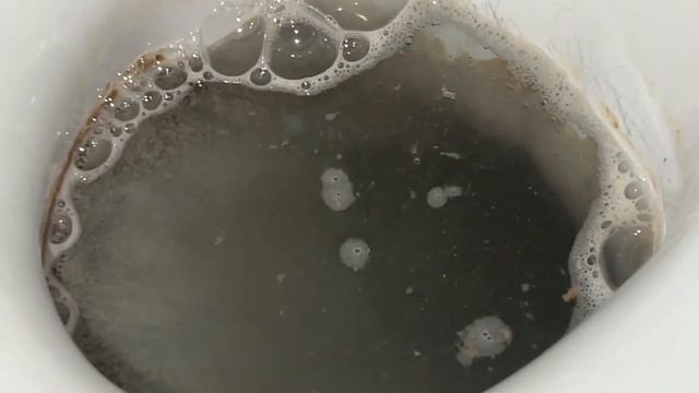 Способ РАБОТАЕТ! Как очистить УНИТАЗ от известкового НАЛЁТА и МОЧЕВОГО камня без усилий! смотреть онлайн