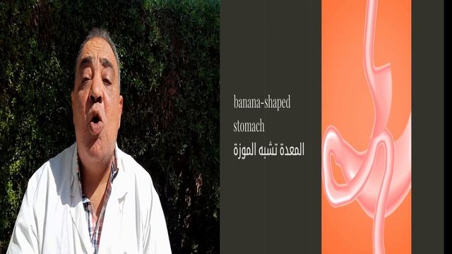 ما هي اضرار وفوائد تكميم المعدة ؟ بكل حيادية смотреть онлайн