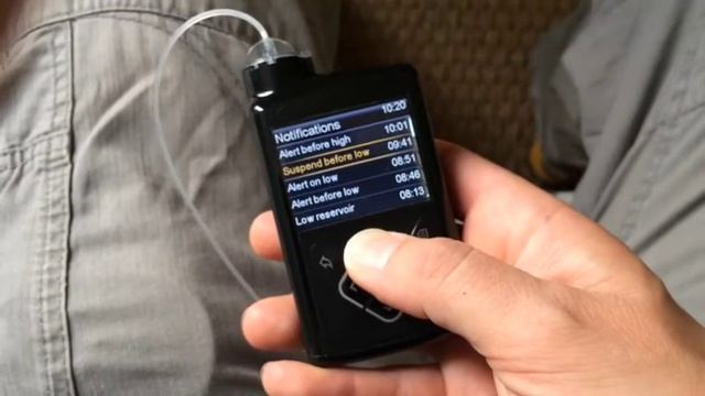 64 Days with the MiniMed 640G Ep8 Fine Tuning SmartGuard смотреть онлайн