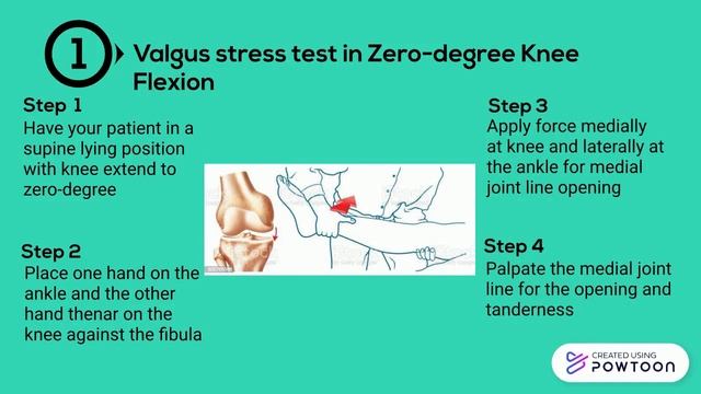 Valgus Stress Test For Medial Collateral Ligament Injury