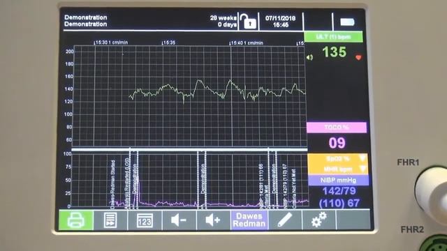 Cardiotocography (Fetal Monitors) | Part 1| Introduction | Biomedical Engineers TV смотреть онлайн