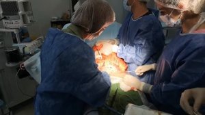 Абдоминопластика - процесс операции. Хирург Константинова Ирина