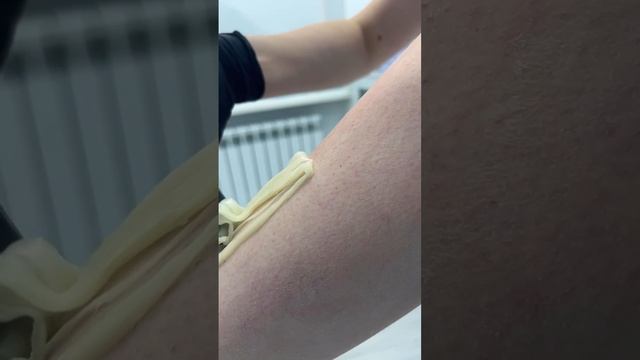 Шугаринг в Epil story ❤️ #лазернаяэпиляция #депиляция #электроэпиляция #косметология смотреть онлайн