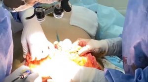 Комплексная операция: пластика груди и живота