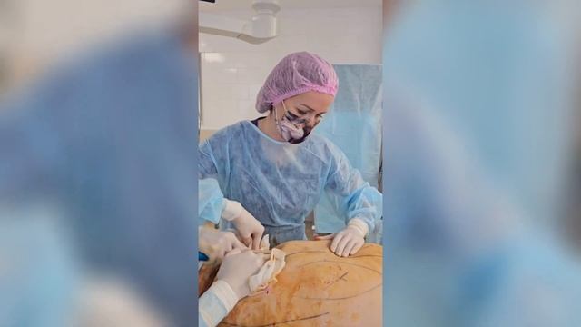 Липосакция живота и боков. Съемка с операционного стола смотреть онлайн