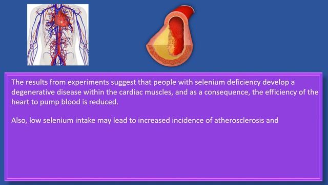 Reasons Why Selenium Is Important To Your Health (Nutrition) смотреть онлайн