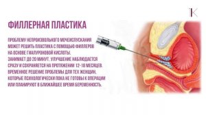 Установка слингов TVT — хирургическая коррекция недержания мочи у женщин