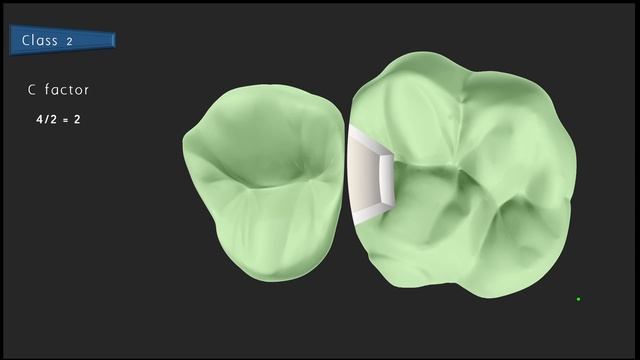C Factor In Dental Composites