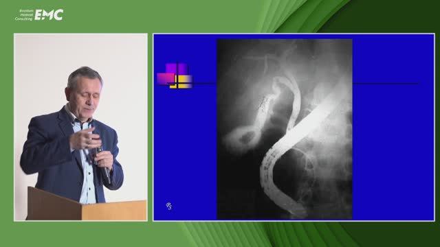 2. Щербаков П.Л. Ретроградные вмешательства у детей, история развития метода (продолжение).