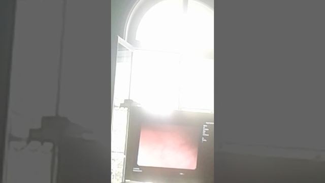 Эндоскоп желудка смотреть онлайн