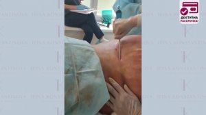 Липосакция боков и зоны «галифе». Пластический хирург Константинова И.В.