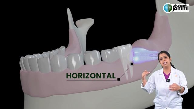 Animation - Quick Relief From Tooth Pain | பல் வலி மற்றும் பல் கூச்சத்திலிருந்து விடுபட எளிய வழிகள் смотреть онлайн