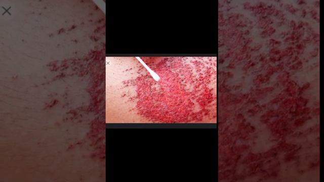 Ayaz Qadri voice lecture #Insect#Fleas#louse#Tick#Prey#predator смотреть онлайн