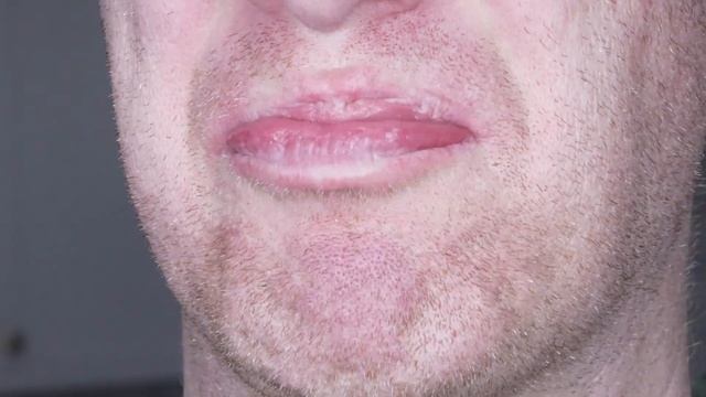 Dentist Explains TOOTH PAIN AFTER EXTRACTIONS! Throbbing, Dry Socket, & Aching For Days After смотреть онлайн