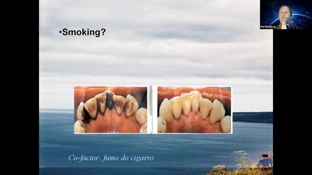 Recent advances in penile cancer: Nextsteps - Rui Medeiros смотреть онлайн