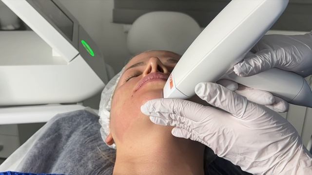 RF-лифтинг в клинике Schmidt Medical, г.Чита