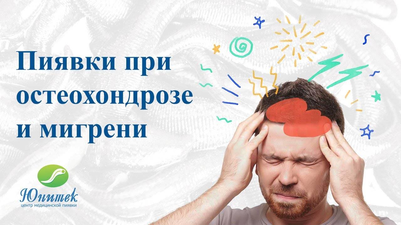 Пиявки при остеохондрозе и мигрени