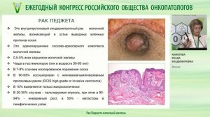 Рак Педжета молочной железы