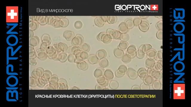 Влияние на эритроциты света Биоптрон смотреть онлайн