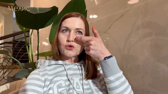 Отзыв пациентки о процедуре инъекции полимолочной кислоты. смотреть онлайн