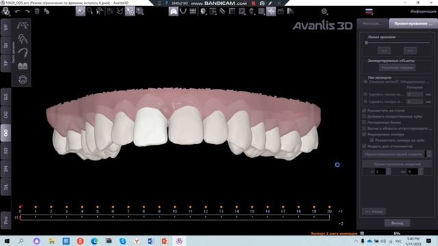 Проектирование моделей для элайнеров