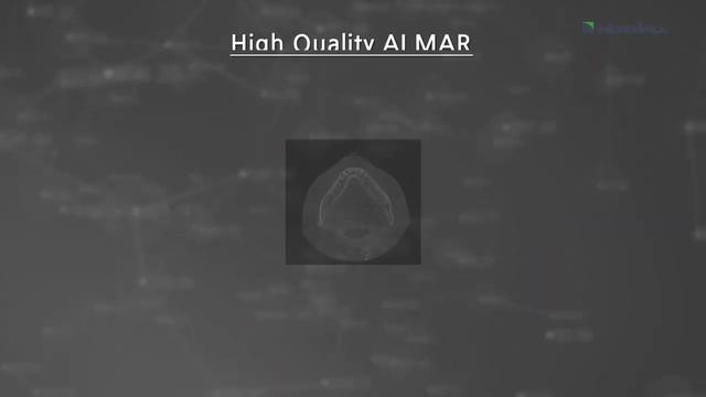 HDXWILL ECO-X CBCT INTRODUCTION смотреть онлайн