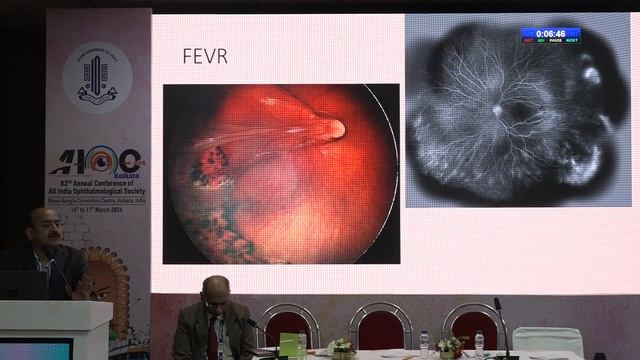 AIOC2024 - GP137 - RETINAL EMERGENCIES FOR THE COMPREHENSIVE OPHTHALMOLOGIST..... смотреть онлайн
