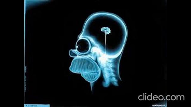 Психические заболевания ,расстройства 3 этап из 6 смотреть онлайн