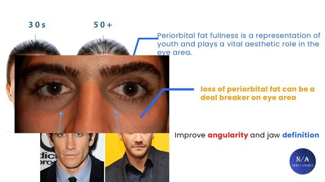 Turn Prey (Buggy) Eyes To Hunter Eyes ? (blackpill) смотреть онлайн