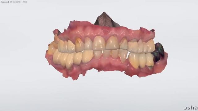 Планирование в 3shape смотреть онлайн
