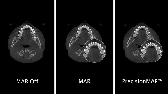 Eco-X, Expand Your Field of View for complete Dental Imaging смотреть онлайн