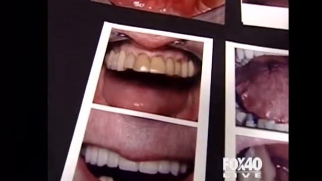 Fox 40 News: Dr Fife on Night Guards, Clenching & Grinding-12.mov смотреть онлайн