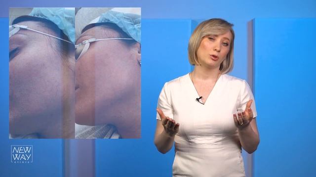 М22 | ФОТОТЕРАПИЯ | ФОТООМОЛОЖЕНИЕ | ПИГМЕНТНЫЕ ПЯТНА| СОСУДЫ смотреть онлайн