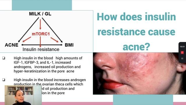 Sweet Retreat: Unwrapping the Sugar-Acne Connection and Mastering Your Clear Skin Challenge смотреть онлайн