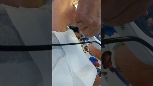 Face Cleaning LW-006