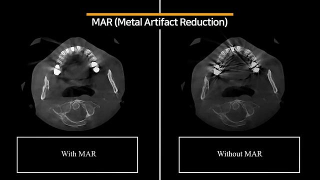 Dentri Max, Everything You Need for Your Growing Practice смотреть онлайн