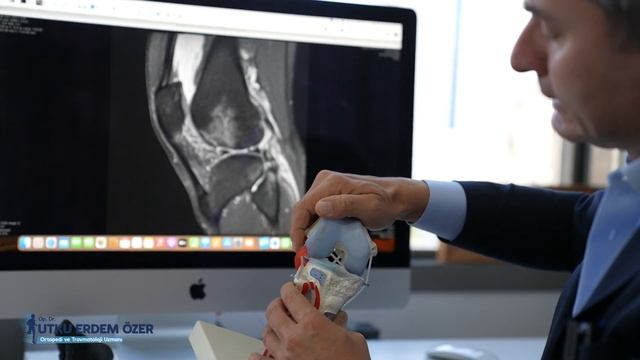 Ön çapraz bağ yırtığında MR görüntüleri | Op. Dr. Utku Erdem Özer смотреть онлайн