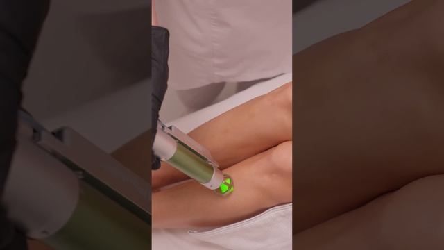 Лазерная эпиляция смотреть онлайн